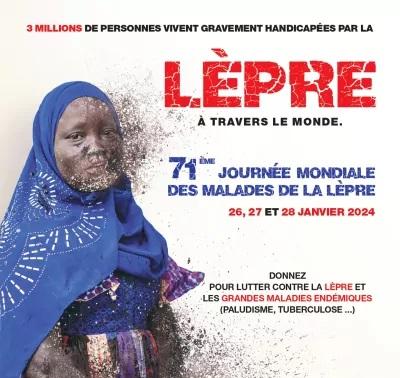 Campagne lepre 71eme affiche a4 page 0001 1 400x566 1