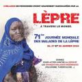 Campagne lepre 71eme affiche a4 page 0001 1 400x566 1